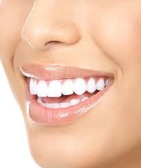 white teeth